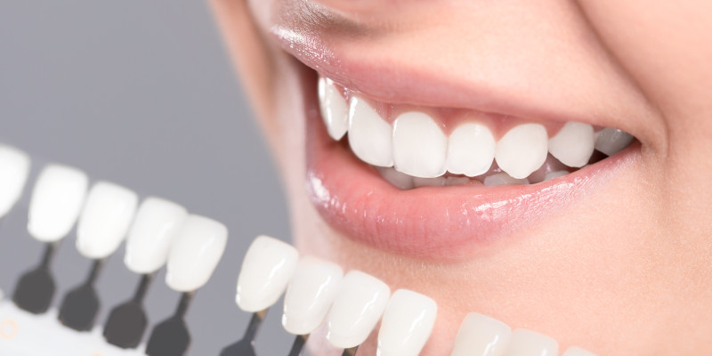 Teeth Whitening in Walkertown, North Carolina