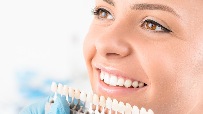 Veneers in Winston-Salem, North Carolina