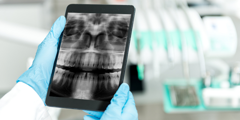Dental X-Rays in Walkertown, North Carolina