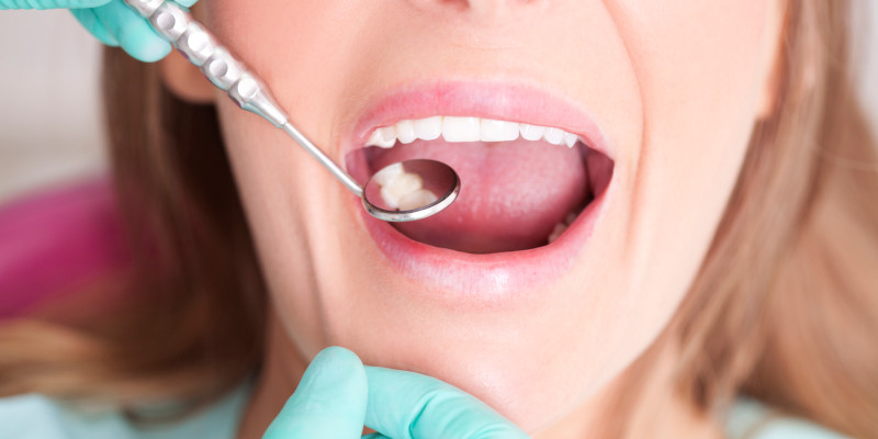 Dental Fillings in Walkertown, North Carolina