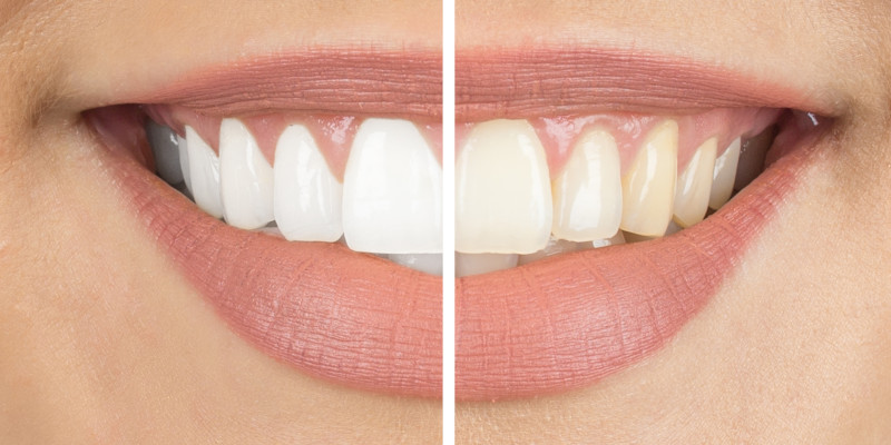 Cosmetic Dentist in Winston-Salem, North Carolina