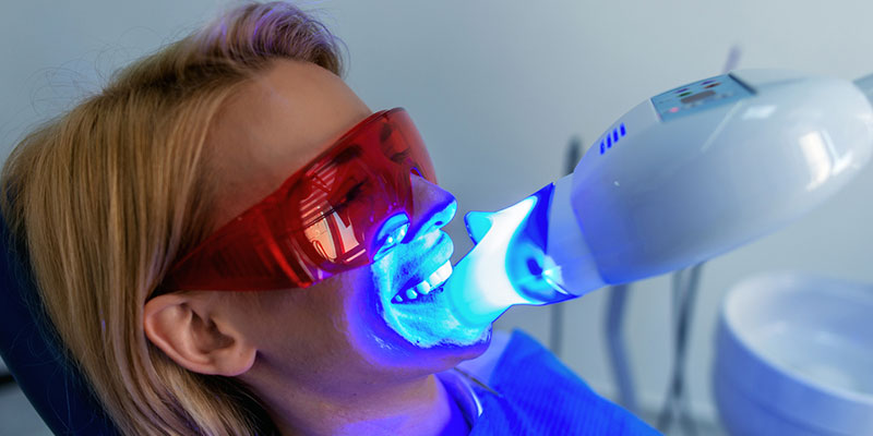 Professional Teeth Whitening vs. At-Home Teeth Whitening